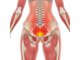 pelvic-floor-specialist-upper-west-side-small-0