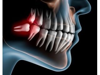 professional-oral-surgeon-for-pain-free-procedures-small-0