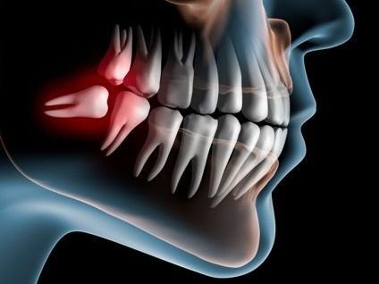professional-oral-surgeon-for-pain-free-procedures