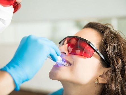 are-same-day-porcelain-crowns-as-durable-as-traditional-crowns