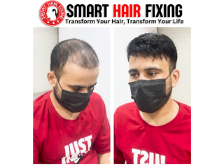 smart-hair-fixing-in-oman-natural-look-instant-results-small-1