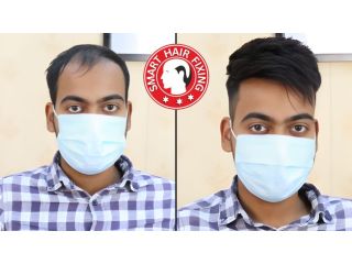 smart-hair-fixing-in-oman-natural-look-instant-results-small-2