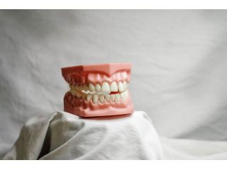 trusted-dentist-in-century-city-for-complete-dental-care-small-3