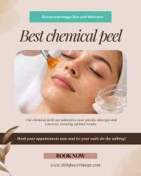 best-chemical-peel-houston-big-0