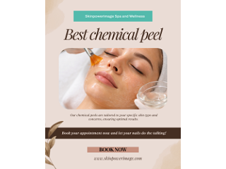 best-chemical-peel-houston-small-0