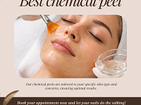 best-chemical-peel-houston