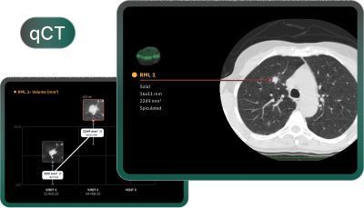 global-ai-healthcare-solutions-for-better-care-big-0
