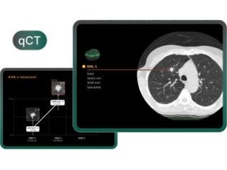 global-ai-healthcare-solutions-for-better-care-small-0