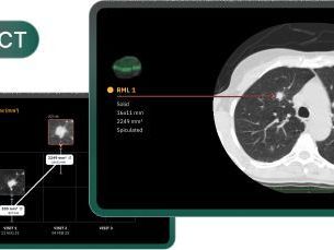 global-ai-healthcare-solutions-for-better-care