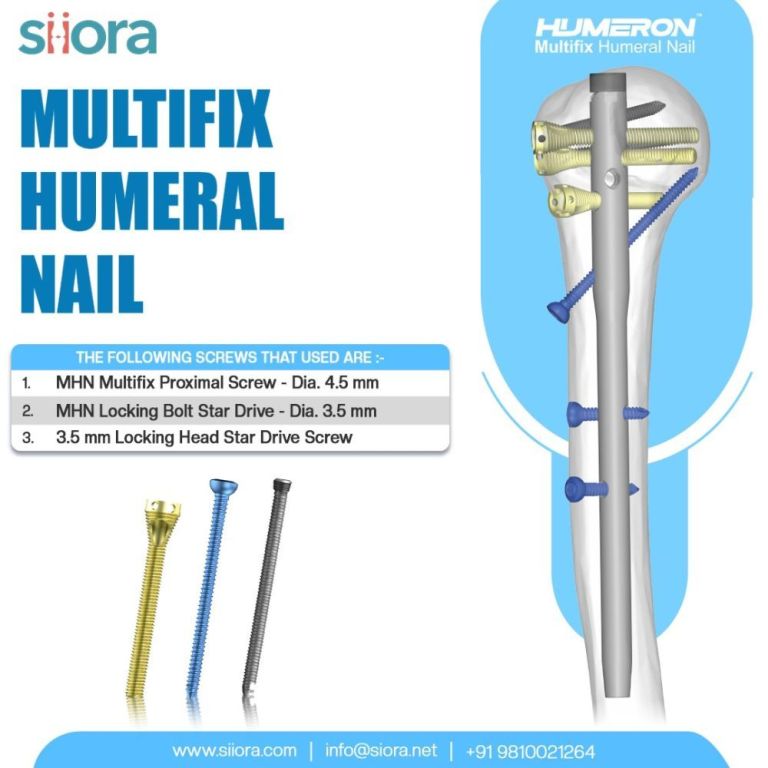 reliable-fixation-with-multifix-humeral-nail-by-siora-surgicals-big-0