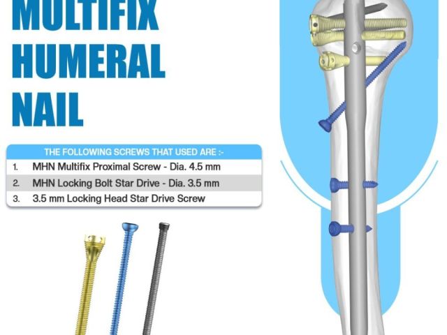 reliable-fixation-with-multifix-humeral-nail-by-siora-surgicals