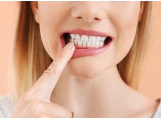 non-surgical-gum-treatment-in-moreno-valley-dr-tejas-modi-small-0