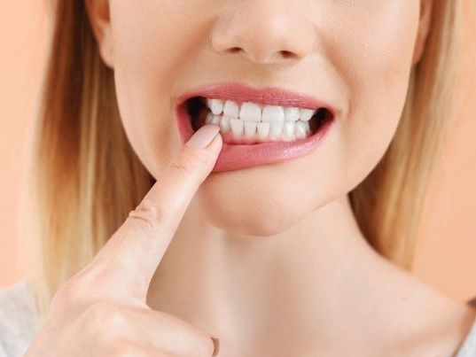 non-surgical-gum-treatment-in-moreno-valley-dr-tejas-modi