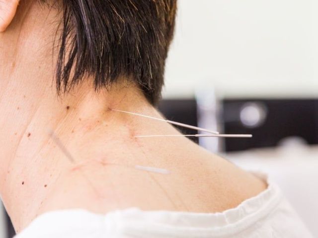 pain-management-acupuncture-in-nyc-back-neck-sciatica-relief