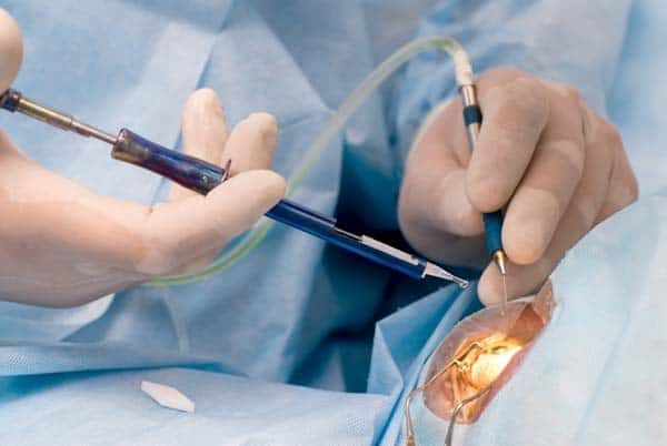 cataract-eye-surgery-service-in-salem-massachusetts-big-0