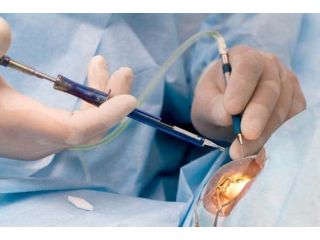 cataract-eye-surgery-service-in-salem-massachusetts-small-0