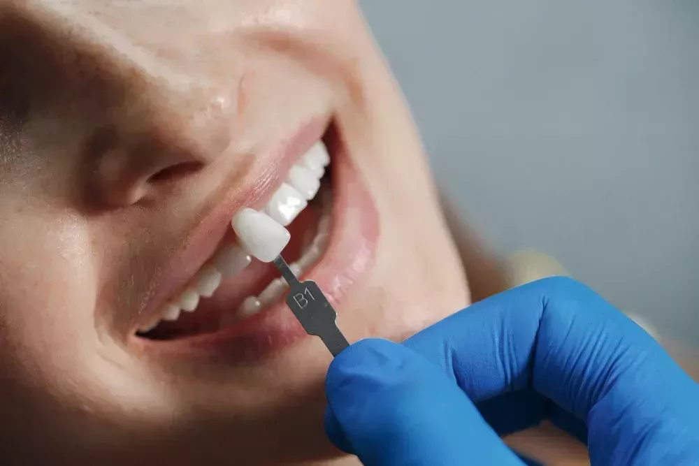 dental-implant-costs-big-0
