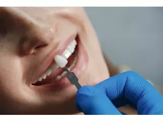 dental-implant-costs-small-0
