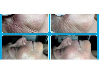 glo2facial-modern-image-waxing-spa-llc-small-0
