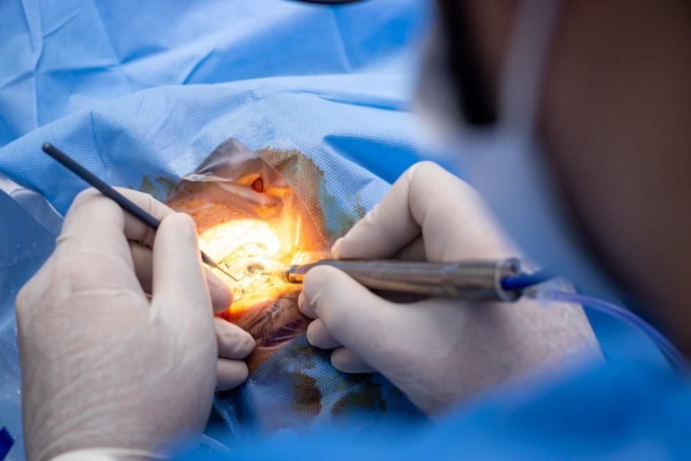 cataract-surgery-center-in-seattle-washington-state-big-0