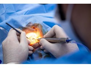 cataract-surgery-center-in-seattle-washington-state-small-0