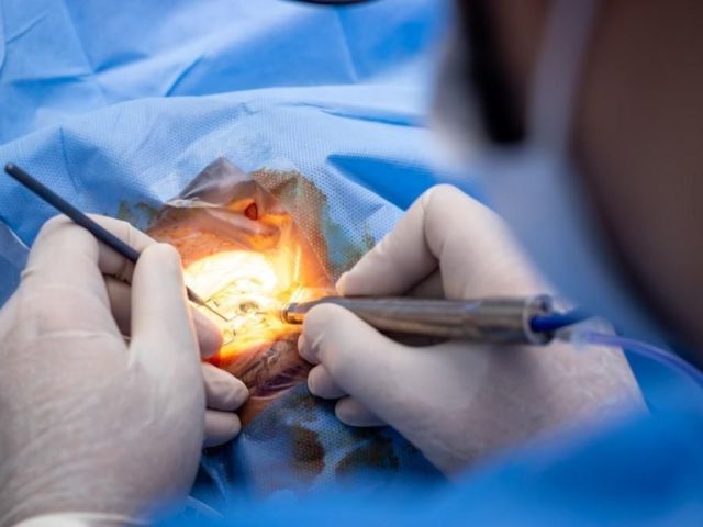 cataract-surgery-center-in-seattle-washington-state
