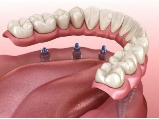 tucsons-best-wellness-dental-services-for-a-healthier-mouth-small-0