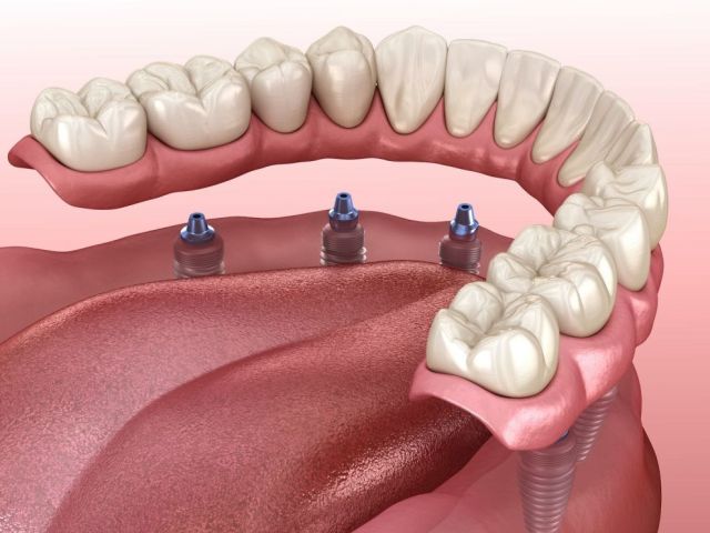 tucsons-best-wellness-dental-services-for-a-healthier-mouth