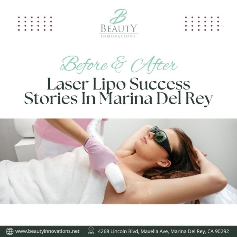 before-after-laser-lipo-success-stories-in-marina-del-rey-big-0