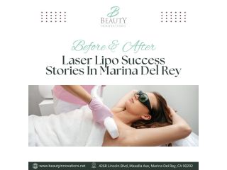 before-after-laser-lipo-success-stories-in-marina-del-rey-small-0