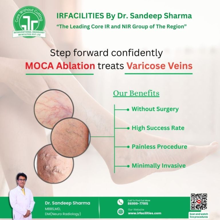 expert-care-from-a-varicose-veins-specialist-for-lasting-relief-big-0