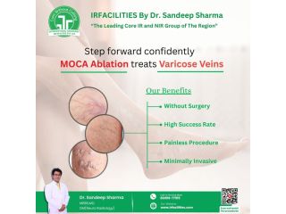 expert-care-from-a-varicose-veins-specialist-for-lasting-relief-small-0