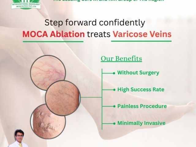 expert-care-from-a-varicose-veins-specialist-for-lasting-relief