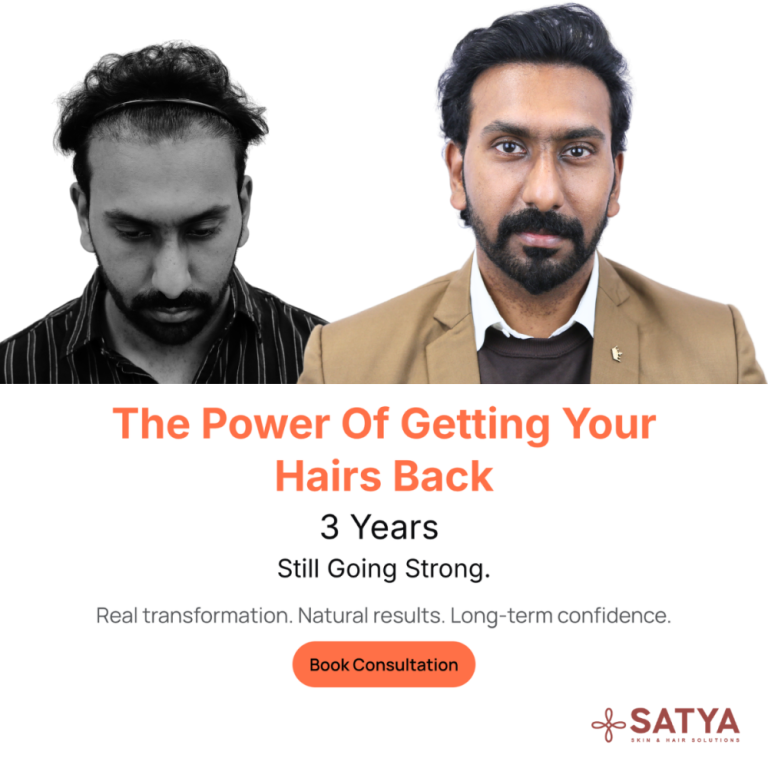 hair-transplant-in-india-big-0