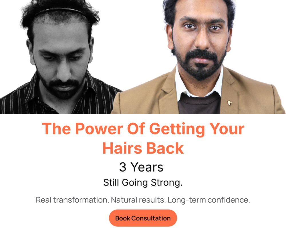hair-transplant-in-india