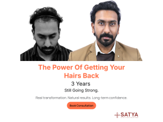 hair-transplant-in-india-small-0