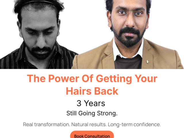 hair-transplant-in-india