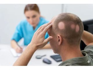trusted-alopecia-specialist-for-hair-loss-ga-small-0