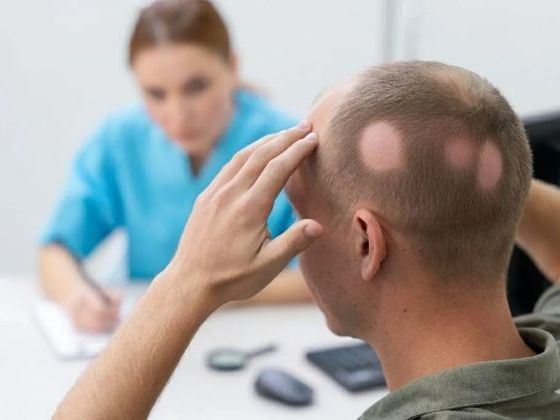 trusted-alopecia-specialist-for-hair-loss-ga