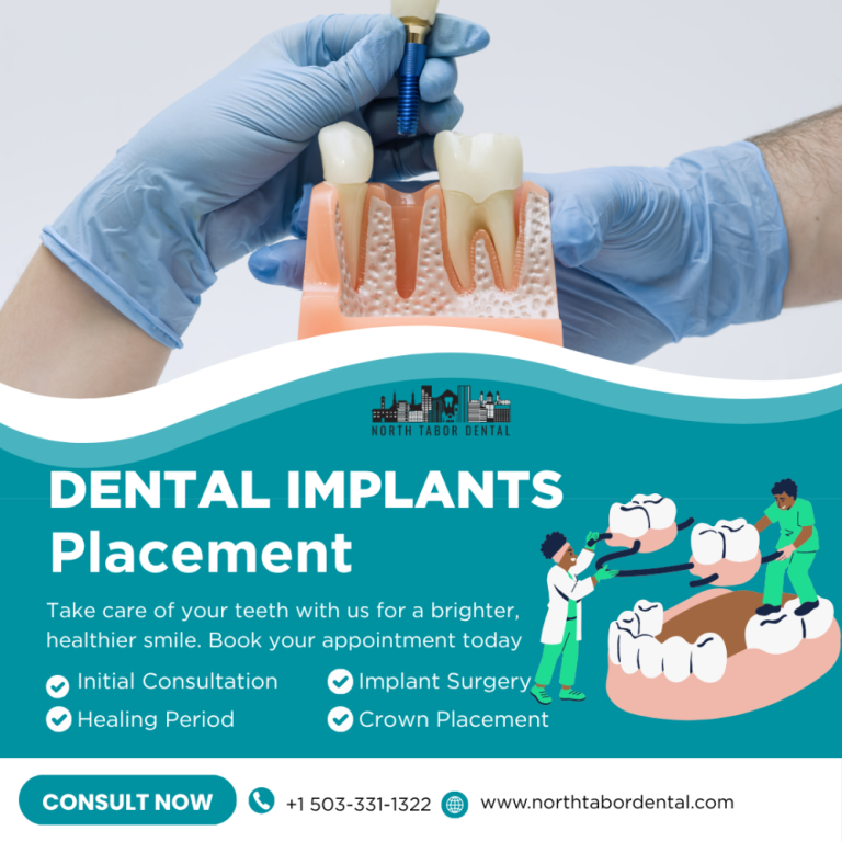 how-safe-is-dental-implants-placement-big-0