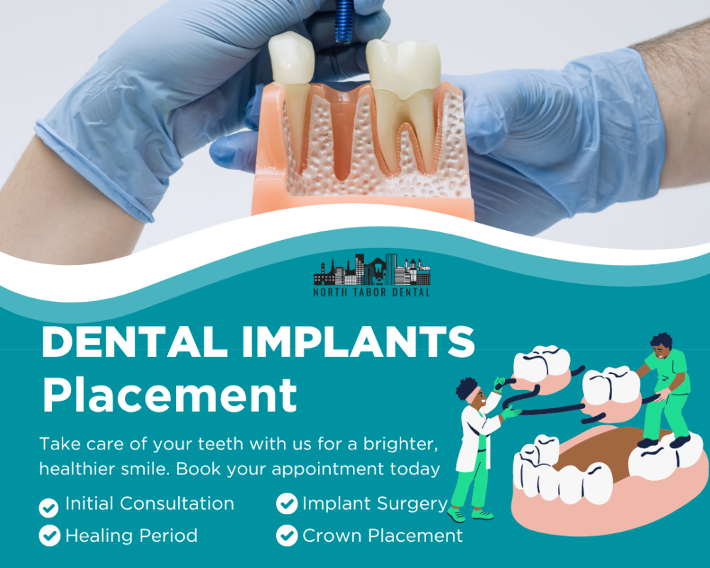how-safe-is-dental-implants-placement