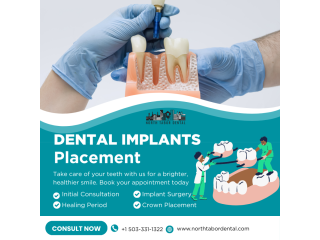 how-safe-is-dental-implants-placement-small-0