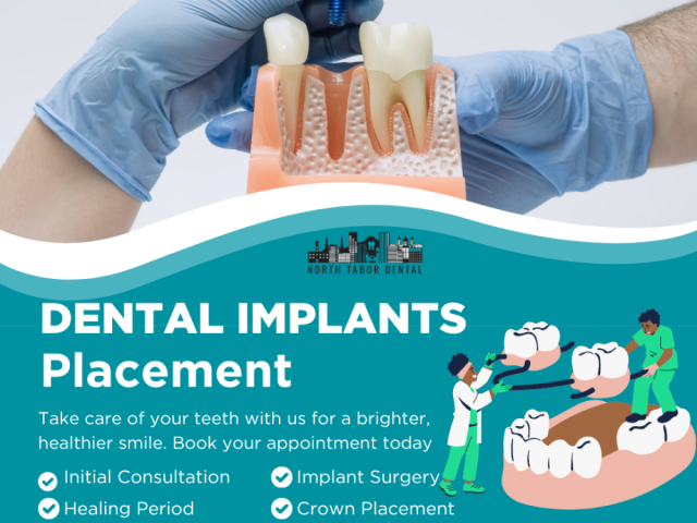how-safe-is-dental-implants-placement