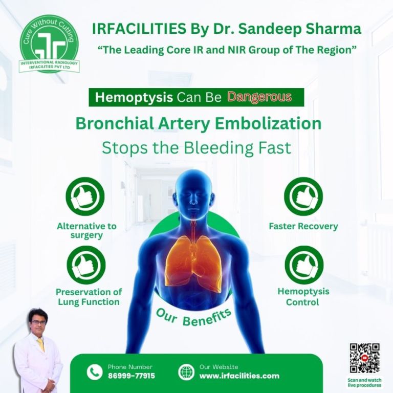 safe-bronchial-artery-embolization-for-effective-bleeding-control-big-0