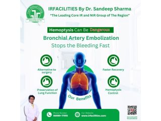 safe-bronchial-artery-embolization-for-effective-bleeding-control-small-0