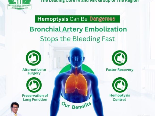 safe-bronchial-artery-embolization-for-effective-bleeding-control