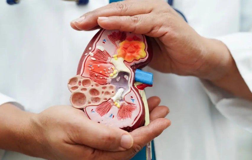 advanced-care-for-kidney-disorder-in-laguna-hills-california-big-0