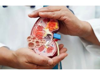 advanced-care-for-kidney-disorder-in-laguna-hills-california-small-0