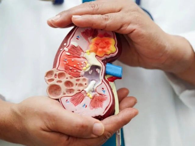 advanced-care-for-kidney-disorder-in-laguna-hills-california
