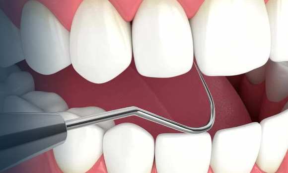 full-mouth-reconstruction-advanced-smile-restoration-big-0